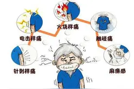 面部痛如闪电，竟是脑肿瘤惹的祸——如何根治"另类"顽固性三叉神经痛图片