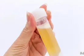 尿里带泡沫，好像「啤酒」，是怎么啦？图片