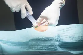 得了膝关节炎，打玻璃酸钠到底管不管用？骨科医生告诉你答案图片