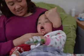 奶奶给孩子只吃这个导致孩子嘴部烂掉，还理直气壮说孩子愿意吃图片