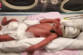 奇迹！36岁高位截瘫妈妈早产，剖腹产下3.9斤男婴视频封面