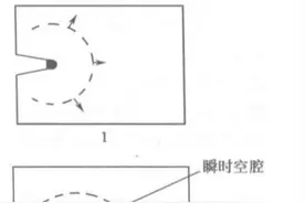 为什么中枪后要马上取出子弹？图片