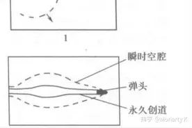 为什么中枪后要马上取出子弹？图片