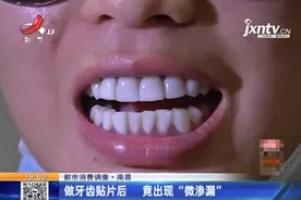 南昌一女子做牙齿贴片，做完后悔不已：“牙齿无法闭合了！”图片