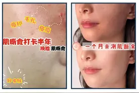 2020流行的7天“肌断食”，真的能换脸吗？| 真人测试图片