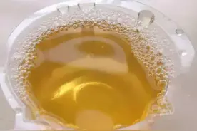 尿液发黄，还伴随一股异味？这是哪里出了问题？图片