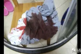 血飙到满床都是！8岁男孩深夜发病，竟是因为TA掉出来了图片