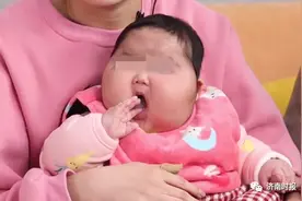 心疼！5个月婴儿竟成“大头娃娃”，真相令人发指！网友：触目惊心图片
