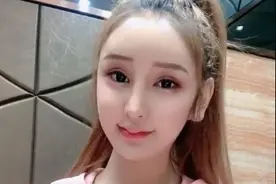 整容后遗症有多可怕？东北假脸网红脸部玻尿酸被冻硬，皮肤无弹性图片