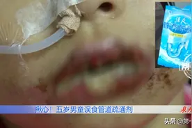 揪心！男童误食管道疏通剂，用水冲洗后口腔血肉模糊图片