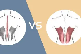 椎间盘突出 VS 腰肌劳损图片
