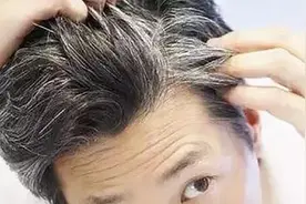 “少年白”是遗传？医生：不一定，补好两种维生素，白发或许变黑图片