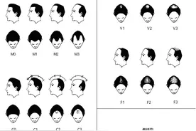 当红小花都在秃头！你也在头皮多油、掉发多？当代人的防秃指南图片