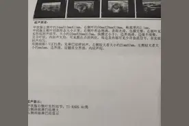 做了甲状腺手术属于慢性病，可以去办个慢保卡图片