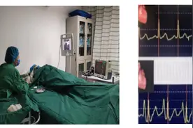 我院成功开展PICC置管心电腔内（ECG）定位技术图片