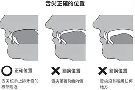 舌头摆放不对影响一辈子！快自测你的对没对图片