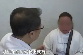 “红脸蛋”3年，女子来长沙求医，经查是得了这种病！专家提醒：避免护肤误区图片