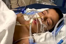 美国男孩腹泻发烧后突然心跳停止，医生发现他竟感染新冠器官衰竭图片