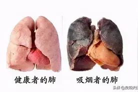 做完支架实在戒不了烟，少抽几口行不行？图片