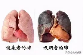 做完支架实在戒不了烟，少抽几口行不行？图片