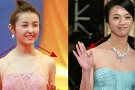 溜肩，脖子粗，斜方肌太发达，要怎样才能消除？图片