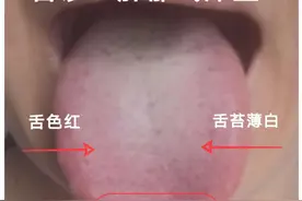 容易生闷气怎么办？图片