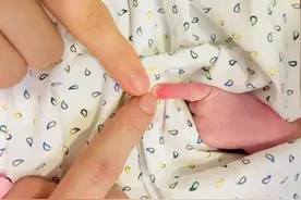 6个月婴儿紧握拳头，奶奶发现不对劲带去医院检查，医生：来晚了图片