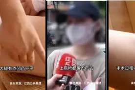 艾嘉仁｜女子抽脂后大腿凹凸不平蹲不下，怎样减肥不伤身呢？图片