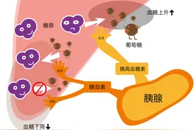 糖尿病的真正病因在哪里？竟然不在胰岛和胰岛素，病根在于肝脏！图片