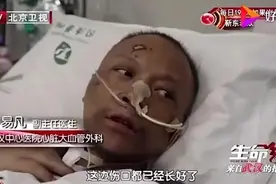 武汉医生皮肤变黑的原因找到！已慢慢恢复图片
