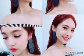 黑痣到底用不用切除，听听医生怎么说！图片