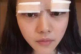 我超级满意我现在的眼睛，一是眼睛大了很多，而且眼睛非常有神图片