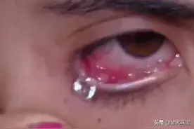 女孩流出的眼泪变成“钻石”，科学也说不清楚是啥原因造成的图片