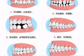 牙齿“正畸”知多少？#雅悦齿科#图片