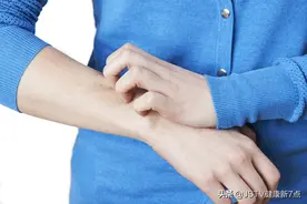 奇痒无比的手指缝 | 专家提醒：警惕春季皮肤病图片
