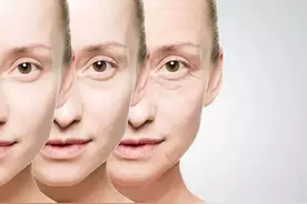 泪沟很明显怎么办｜医美干货分享图片