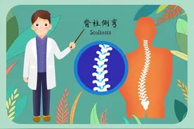 暑假脊柱侧弯学生就诊增多，这个新技术带来新进展！图片