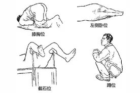 如何早期发现大肠癌？图片