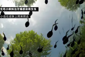 为治牙痛，五旬阿姨每天生吃小蝌蚪！一查发现感染寄生虫，病灶遍布各个器官图片