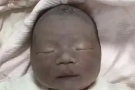 新生儿太黑遭父母嫌弃，医生劝再等等，最后逆袭成功让父母惊喜图片