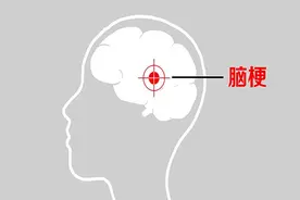 脑梗发生前，十有八九会发出8个信号，牢记“3不、2控、1戒”图片