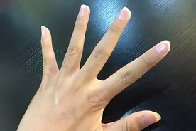 手指僵硬不是小事，医生提醒：可能是这五种疾病导致的图片