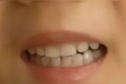 这其实真的可以不用上医院图片