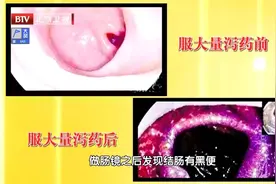 一味枳实三味药！简单泡一泡调理脾胃、护心利胆，名老中医也常用图片