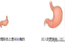 新生儿正常生理现象解读图片