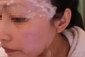 在家自己打水光，真不怕感染？图片