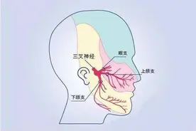 带状疱疹、三叉神经痛和肾结石，哪个才是“疼痛之王”？排名已出图片