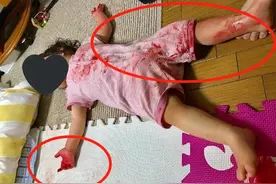妈妈出门买菜，回家发现女儿倒在"血泊"中，大哭时孩子突然坐起图片