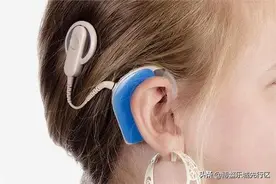 关于人工耳蜗，你想知道的都在这里！图片
