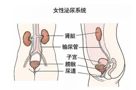 槽糕！尿频尿急尿不尽！尿路感染了怎么办？女性常会碰到的问题图片